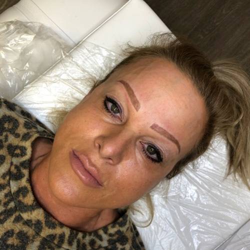 After Eyebrow Microblading After Eyebrow Microblading